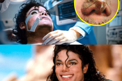 Esto fue lo que le OCURRIÓ a la NARIZ de Michael Jackson