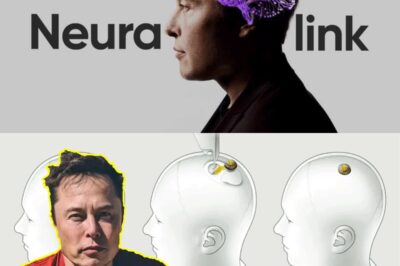 A pesar del éxito del chip cerebral de Elon Musk
